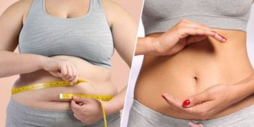 grasa abdominal